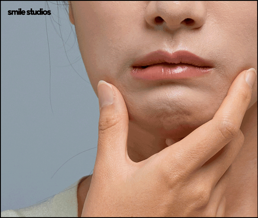 인비절라인 고무줄 착용해야 할까요? 기능 확인 관련 이미지 2