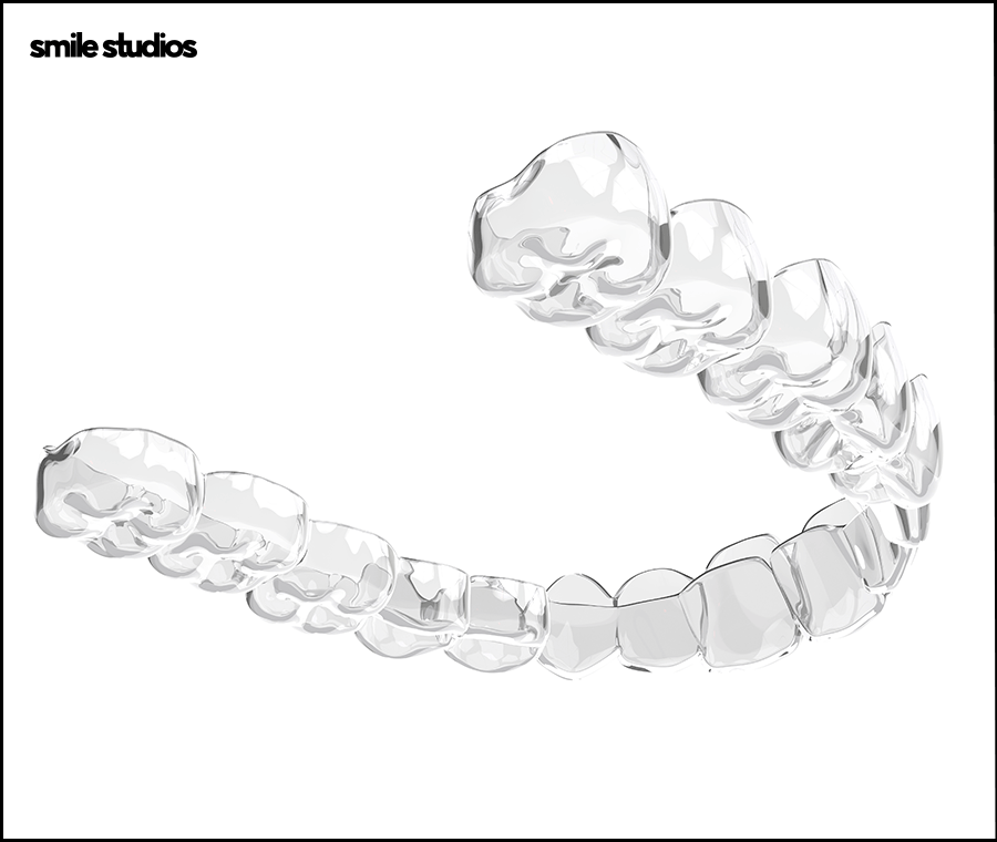 강남 인비절라인 찾는 이유, 치료 가능 범위는? 관련 이미지 3