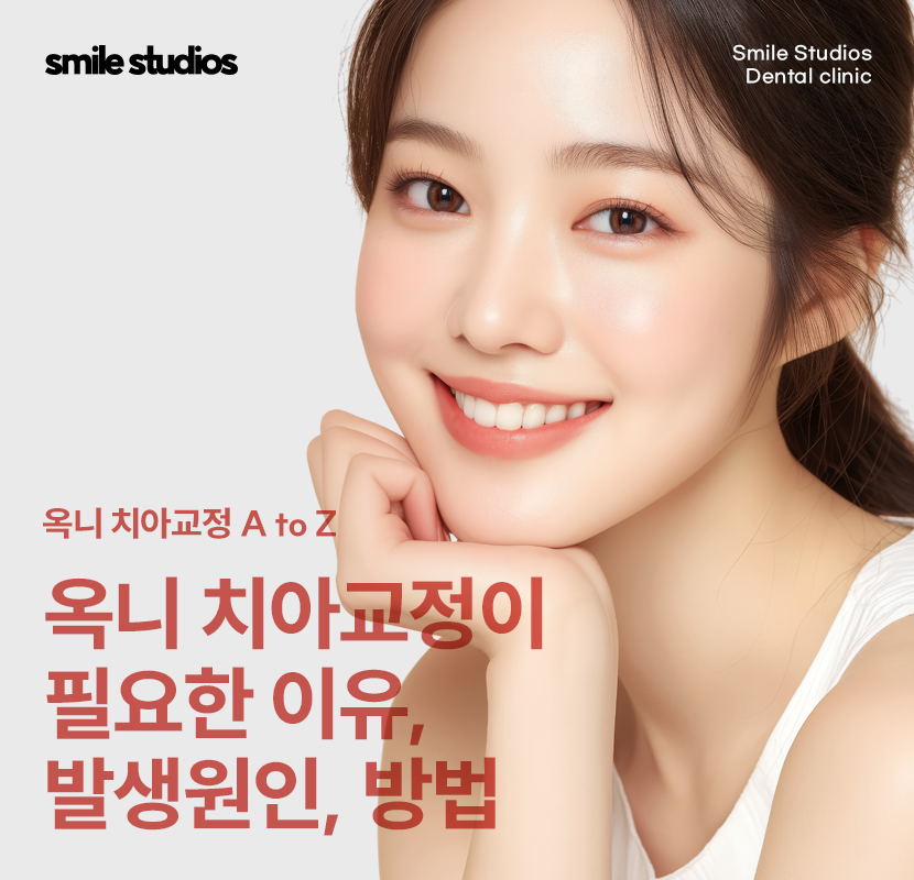 옥니 교정 필요한 이유, 발생 원인, 방법 파헤치기 관련 이미지 1