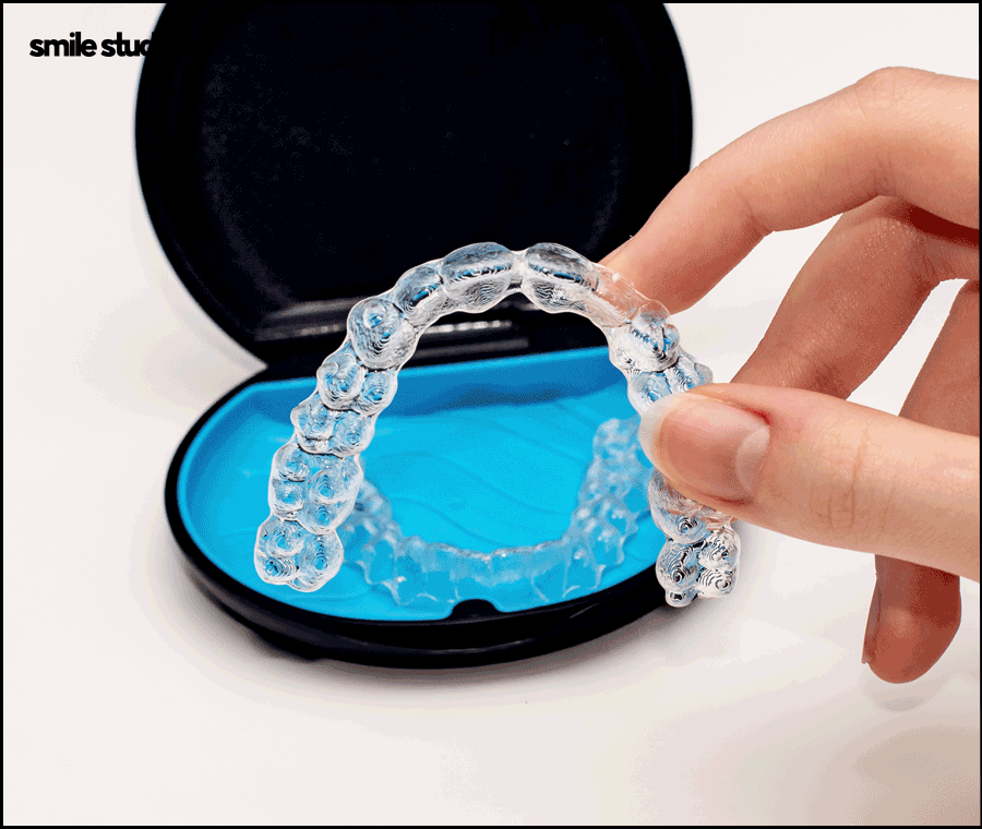 돌출입 인비절라인 기간, 과정, 개선 효과 관련 이미지 10