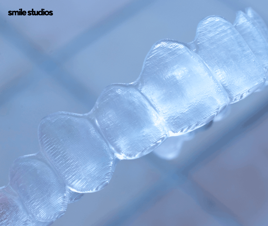 인비절라인 유지장치 착용 기간, 주의사항 알아보기 관련 이미지 4