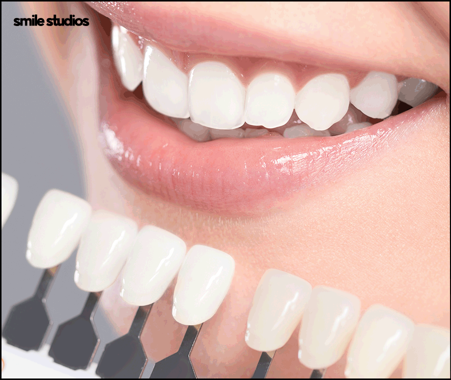 강남무삭제라미네이트 시작 전 확인할 핵심 포인트 관련 이미지 3