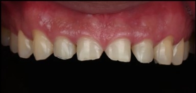 강남라미네이트 혹시 아직도 관련 이미지 8