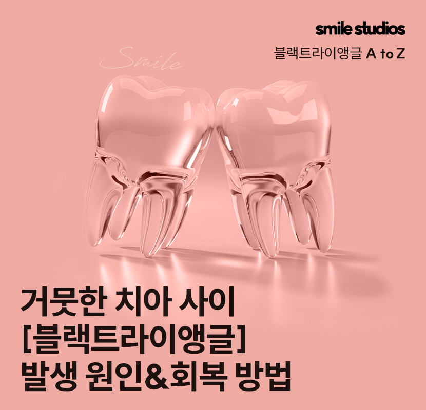 치아 사이 검은색 나타나는 이유, 회복 방법은? 관련 이미지 1