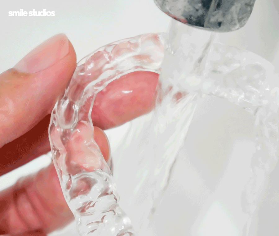 서울 논현동 치과 앞니 투명교정 장단점 총 정리 관련 이미지 7