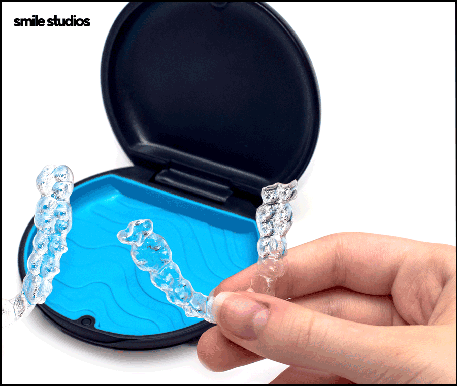 덧니교정 비용보다 중요하게 생각해야 하는 핵심 관련 이미지 5