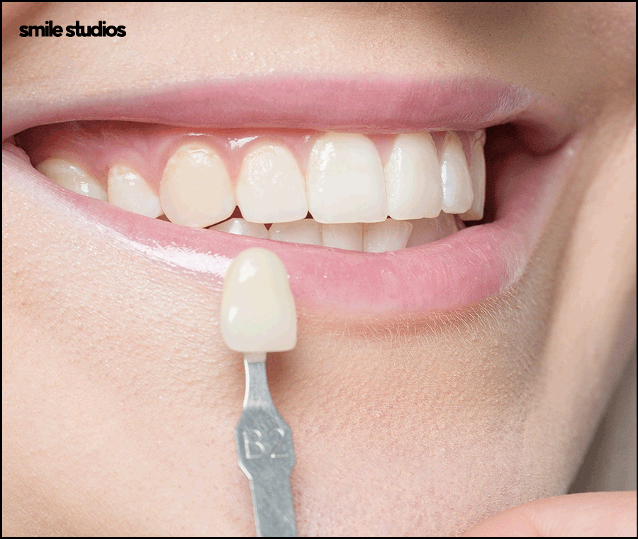 라미네이트 코팅이란? 원리와 기대 효과, 추천 대상 관련 이미지 4