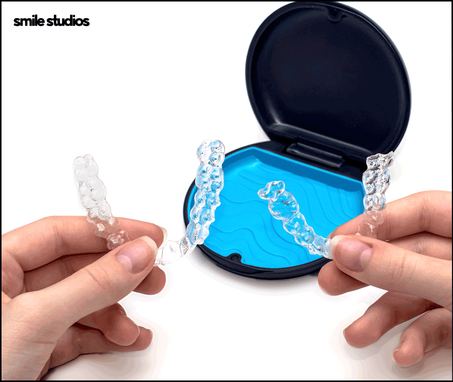 토끼이빨교정, 올바른 정렬을 위한 효과적인 방법은? 관련 이미지 5