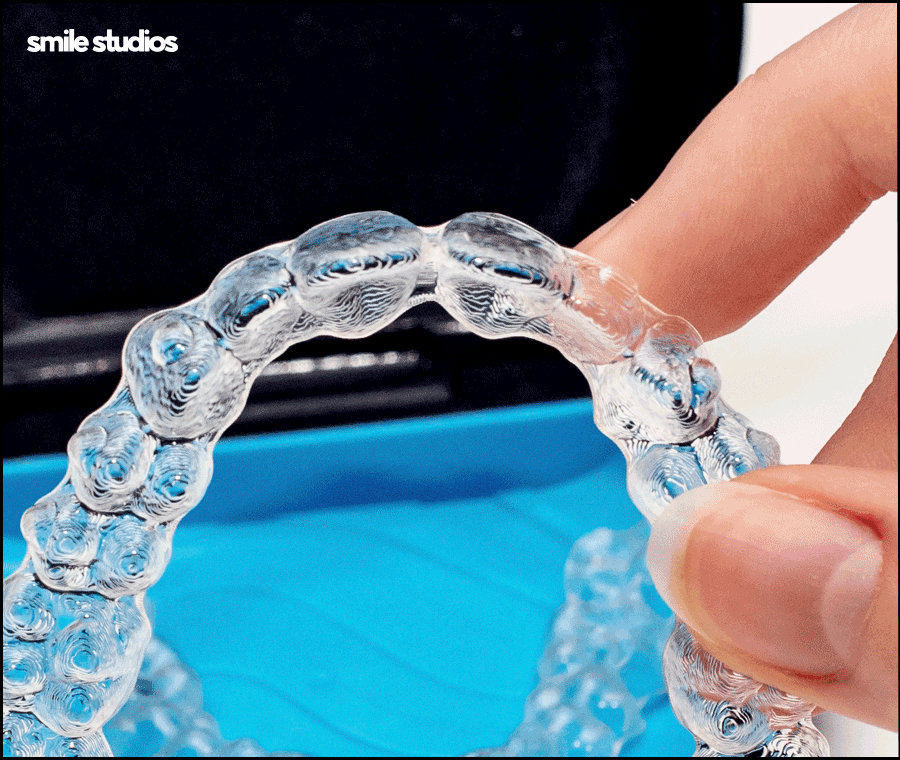 반포동 치과 돌출입 교정, 인비절라인 효과는? 관련 이미지 9