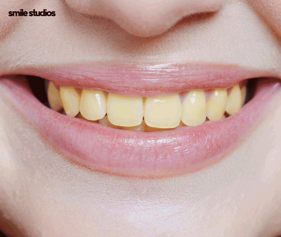 라미네이트가격 및 달라지는 기준, 확인하기 관련 이미지 9