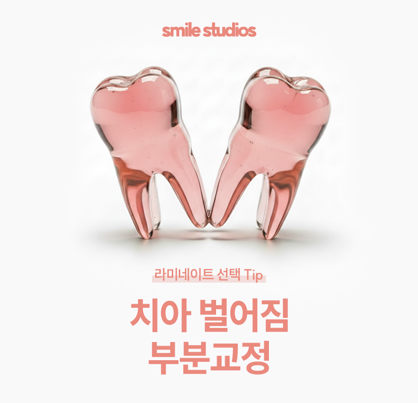 이빨사이벌어짐 부분 교정, 라미네이트 선택 Tip 관련 이미지 1