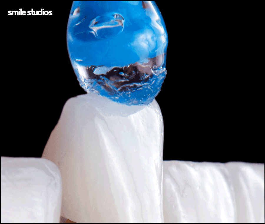 라미네이트 빠짐, 재부착 가능할까요? +대처방법 관련 이미지 3