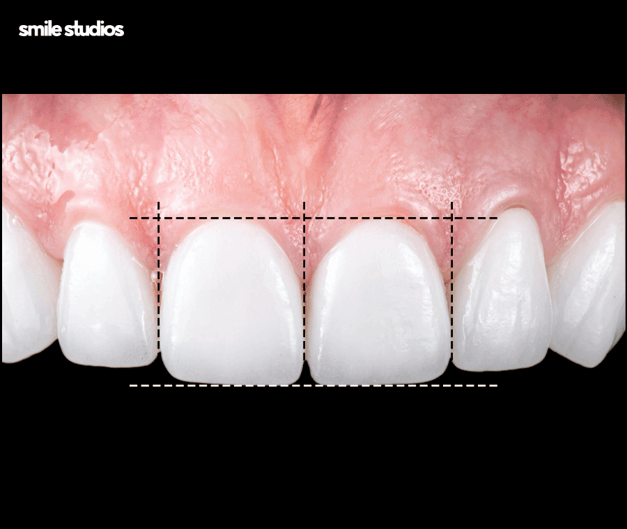 언주역치과 선택 시 꼭 확인해야 할 포인트는? 관련 이미지 6