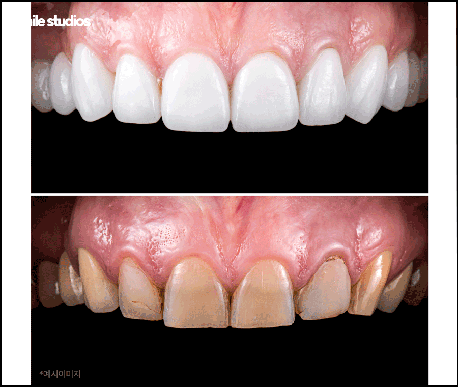 라미네이트 코팅이란? 원리와 기대 효과, 추천 대상 관련 이미지 9