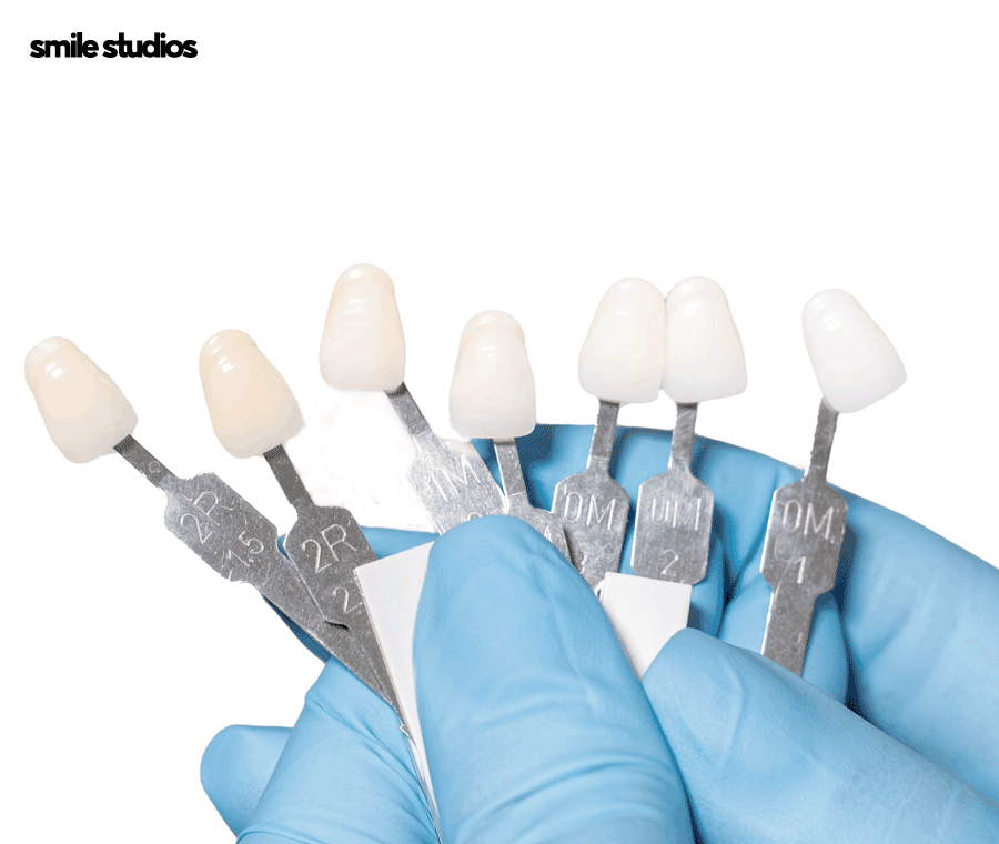 학동역치과 라미네이트 고민된다면 사전에 확인할 점 관련 이미지 7