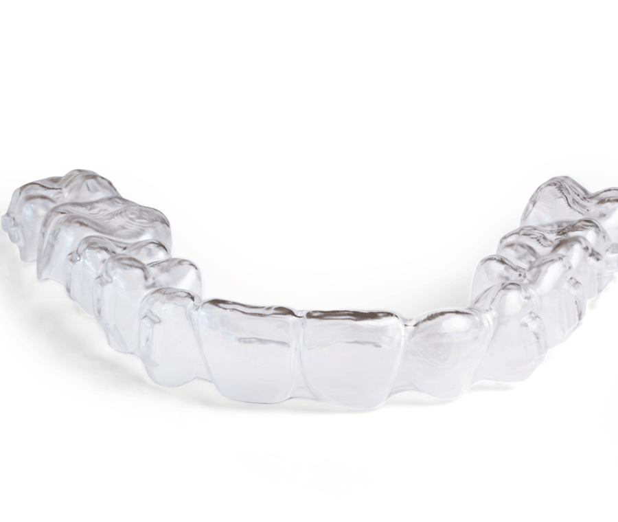 이빨교정비용 좌우하는 기준점 알아보기 관련 이미지 10