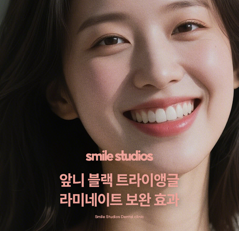 앞니 블랙트라이앵글 보완을 위한 라미네이트 효과 관련 이미지 1