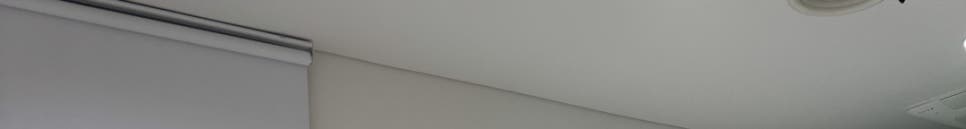 강남역치아미백, 라미네이트로 오래도록 환하게 관련 이미지 21