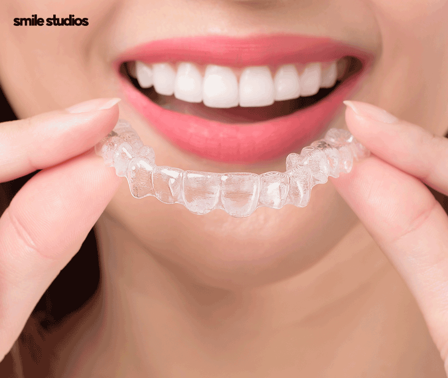 인비절라인 부작용, 장단점 총 정리해 드립니다 관련 이미지 4