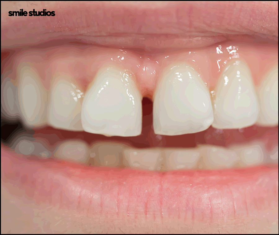 라미네이트가격 및 달라지는 기준, 확인하기 관련 이미지 2