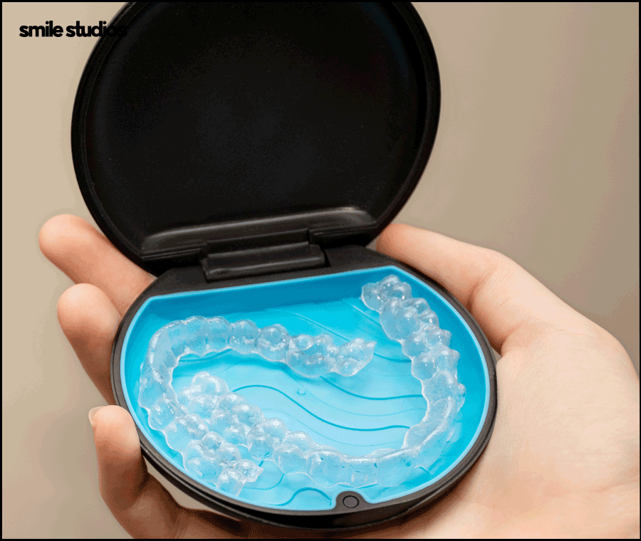 서울인비절라인 권장 케이스, 장점, 치료 시간 정리 관련 이미지 7