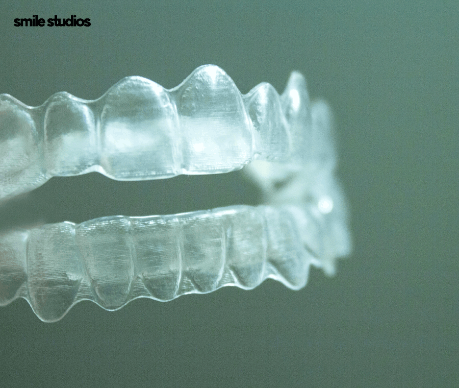 인비절라인 부작용, 장단점 총 정리해 드립니다 관련 이미지 6