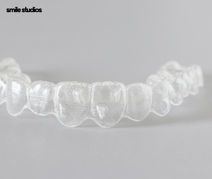 인비절라인 어태치먼트 부착 원리, 탈락 시 대처법 관련 이미지 8