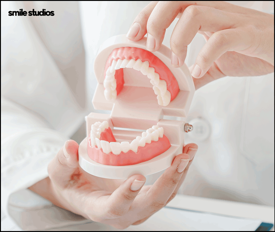 선정릉역치과 인비절라인 교정 전 필수 확인 사항 관련 이미지 10