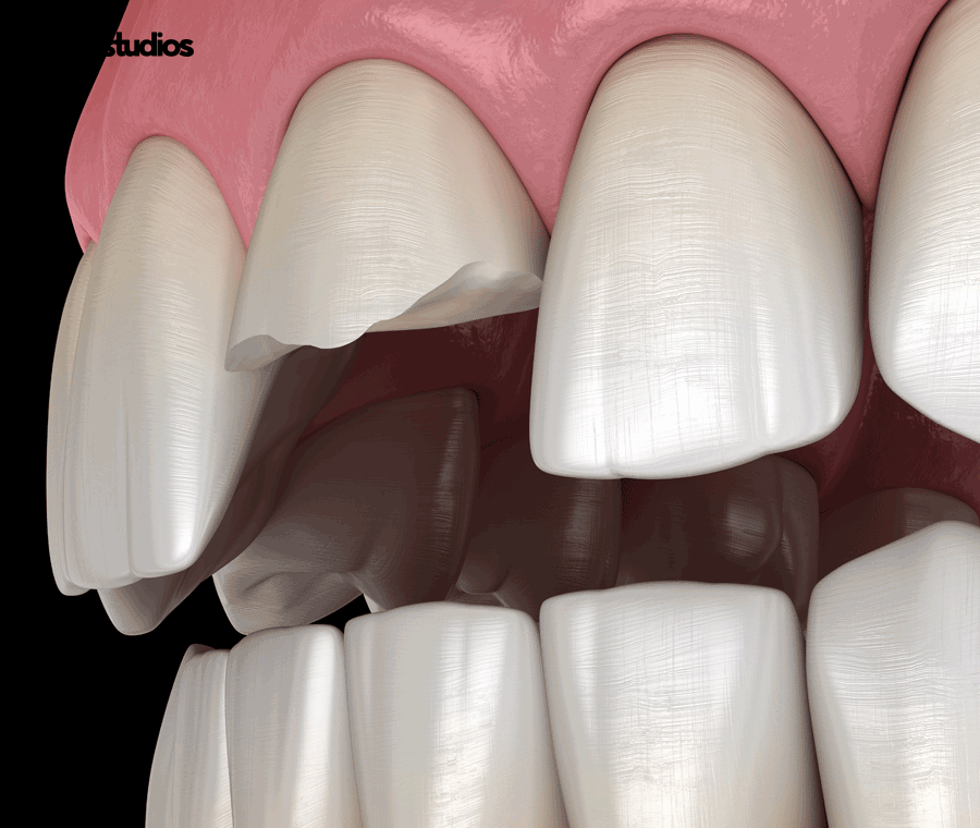 라미네이트가격 및 달라지는 기준, 확인하기 관련 이미지 8