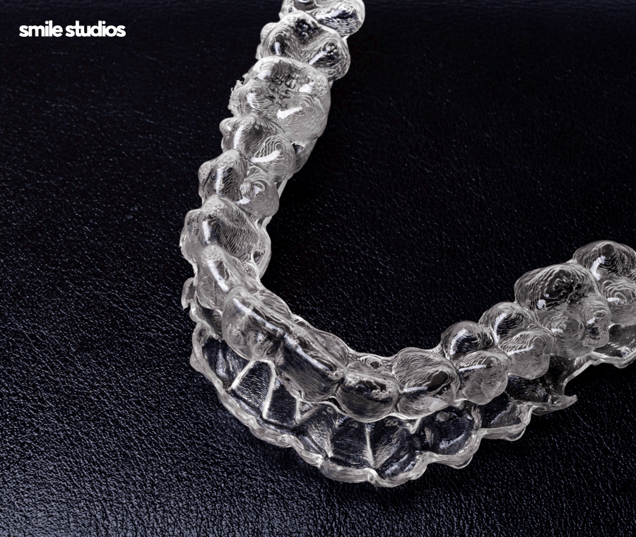 잠원동치과 투명교정 나노라이너, 인비절라인 비교 관련 이미지 6