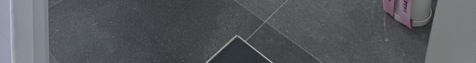 라미네이트치과, 벌어진 앞니 틈? 이것 모르면 평생 후회! 관련 이미지 20