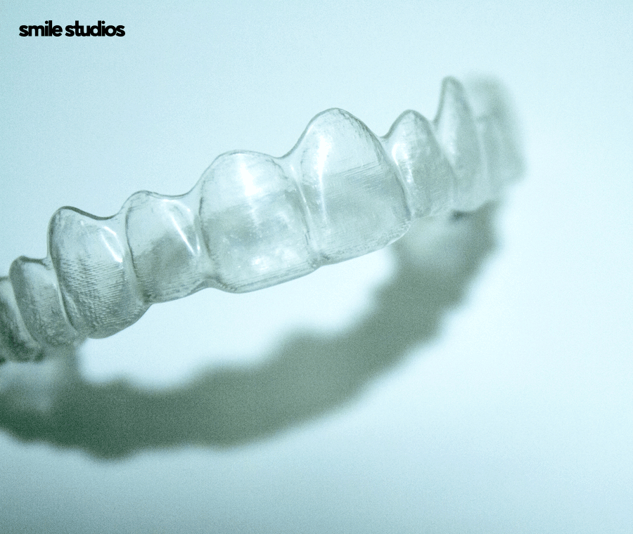 인비절라인 고무줄 착용해야 할까요? 기능 확인 관련 이미지 6