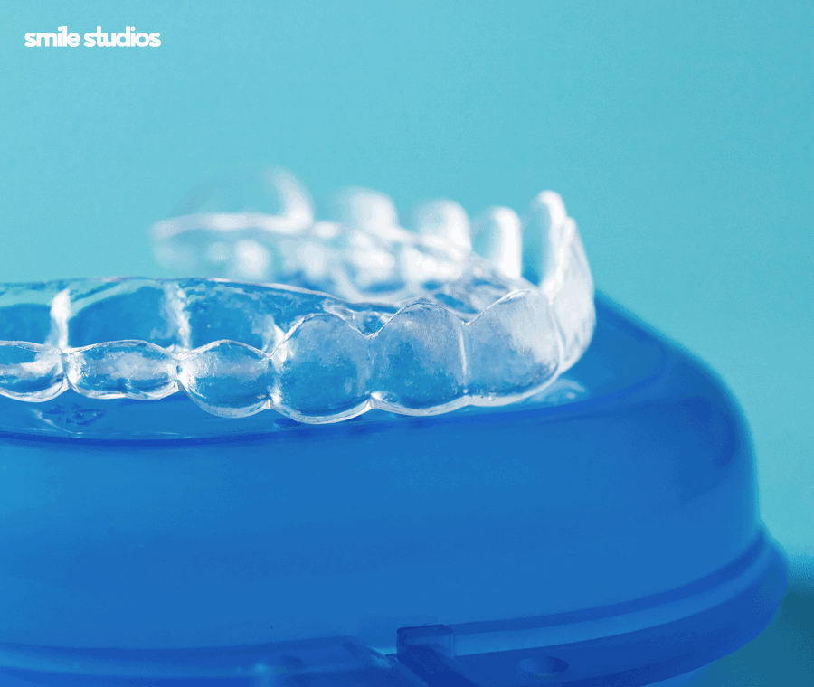 옥니 교정 필요한 이유, 발생 원인, 방법 파헤치기 관련 이미지 10