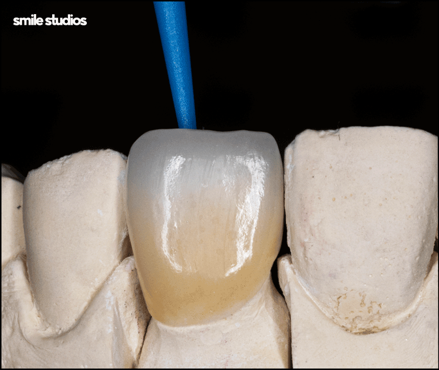 강남라미네이트 기대 효과, 원리, 유지기간 관련 이미지 4