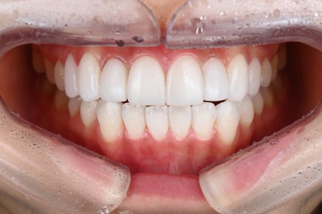 강남라미네이트 혹시 아직도 관련 이미지 4