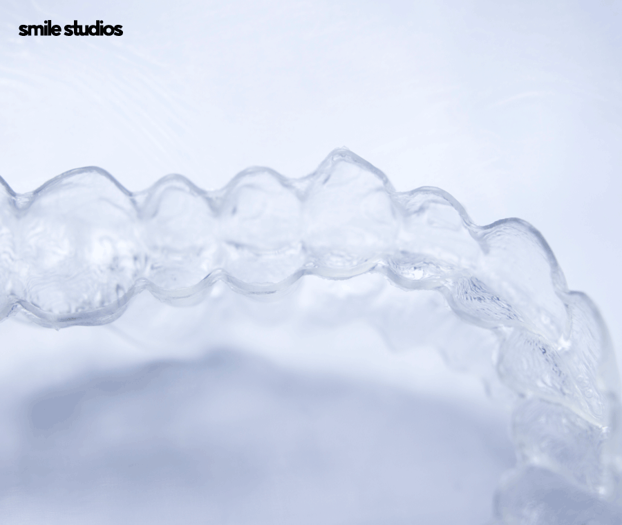 연예인 치아교정 심미성이 우수한 방법 2가지 관련 이미지 7