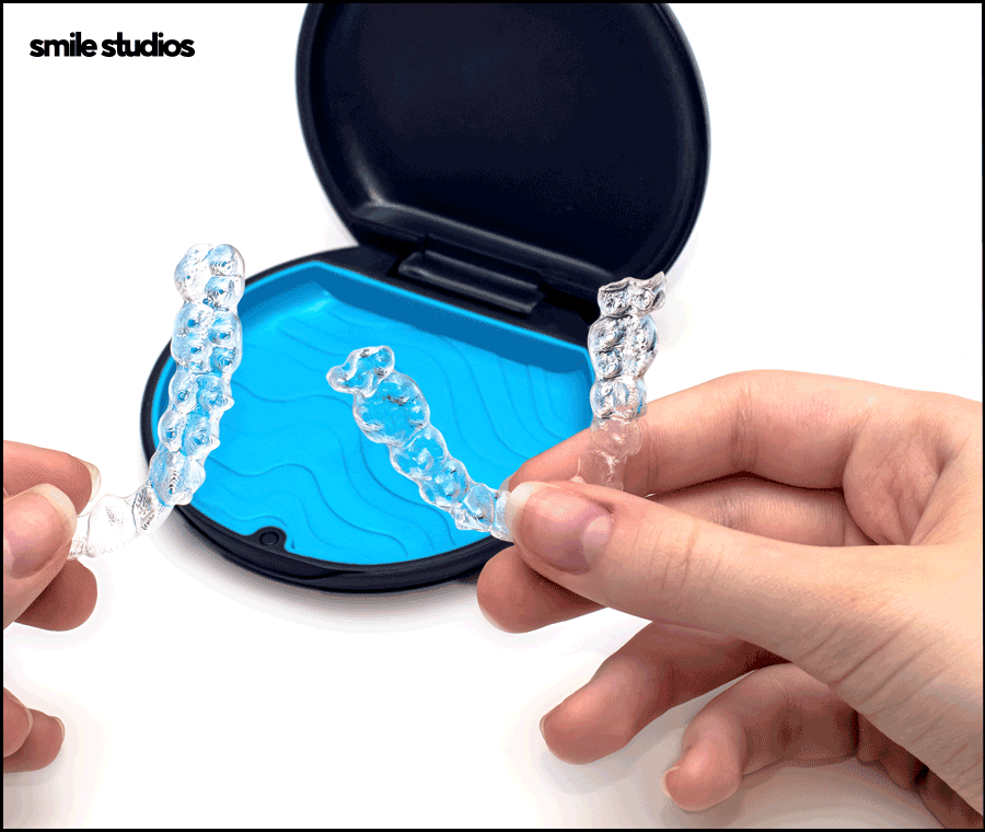 강남 논현 치과 투명 치아교정 시작 전 확인사항 관련 이미지 5