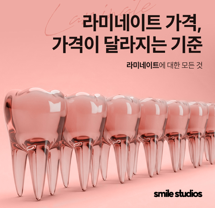 라미네이트가격 및 달라지는 기준, 확인하기 관련 이미지 1