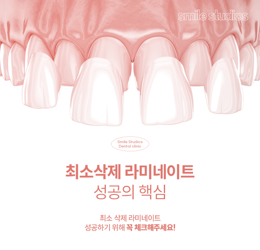 최소삭제 라미네이트 성공하려면 체크할 점 관련 이미지 1