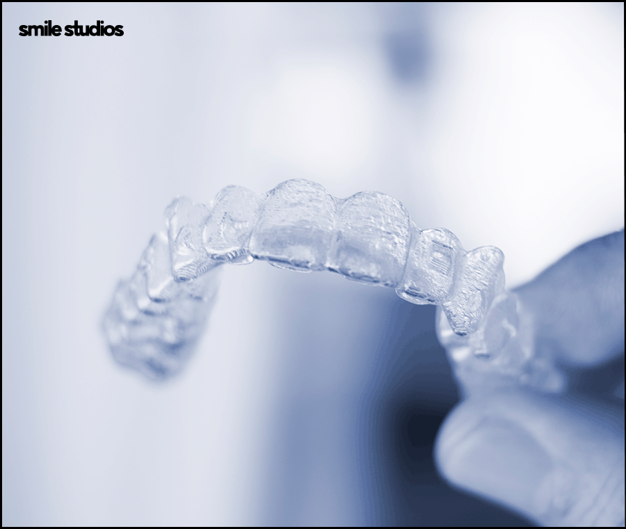 What Are the Key Points That Affect the Success of Receding-Chin Correction? image 8