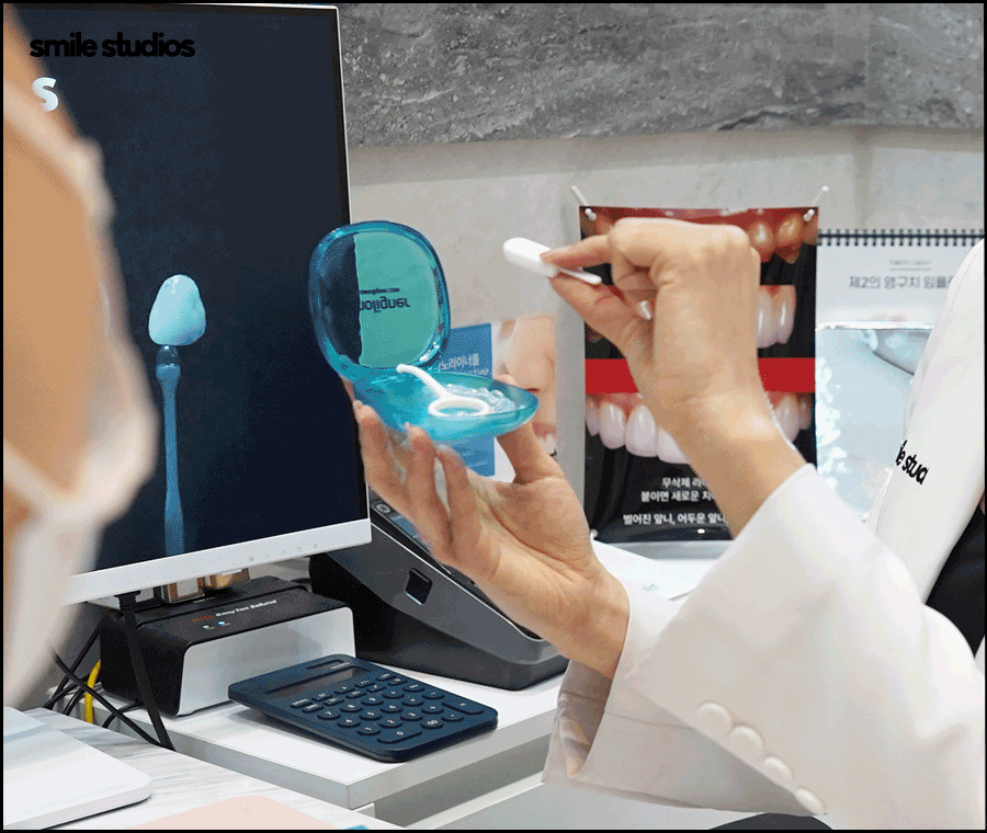 연예인 치아교정 심미성이 우수한 방법 2가지 관련 이미지 6