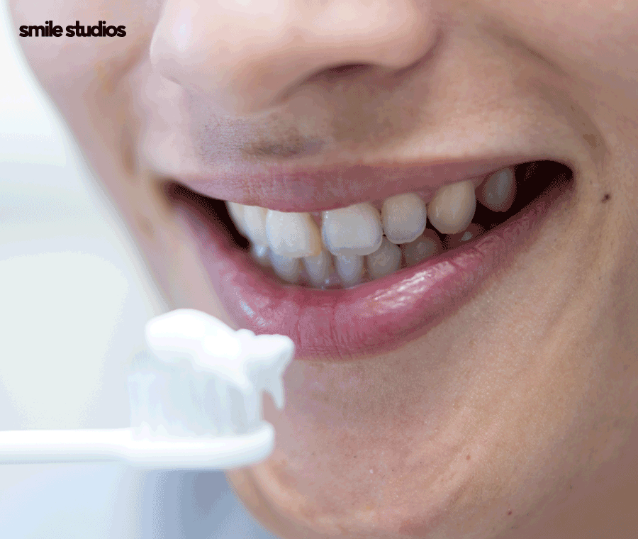 라미네이트 변색, 발생하는 이유, 시점, 대처 방법 관련 이미지 9