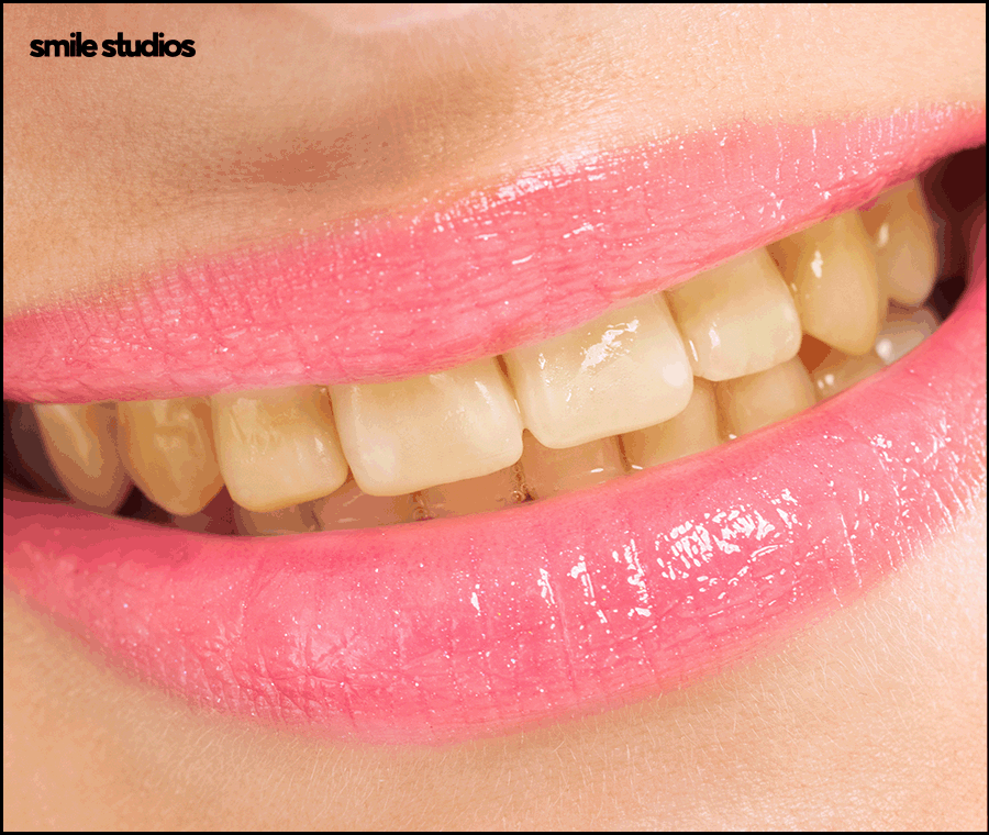 라미네이트가격 및 달라지는 기준, 확인하기 관련 이미지 10