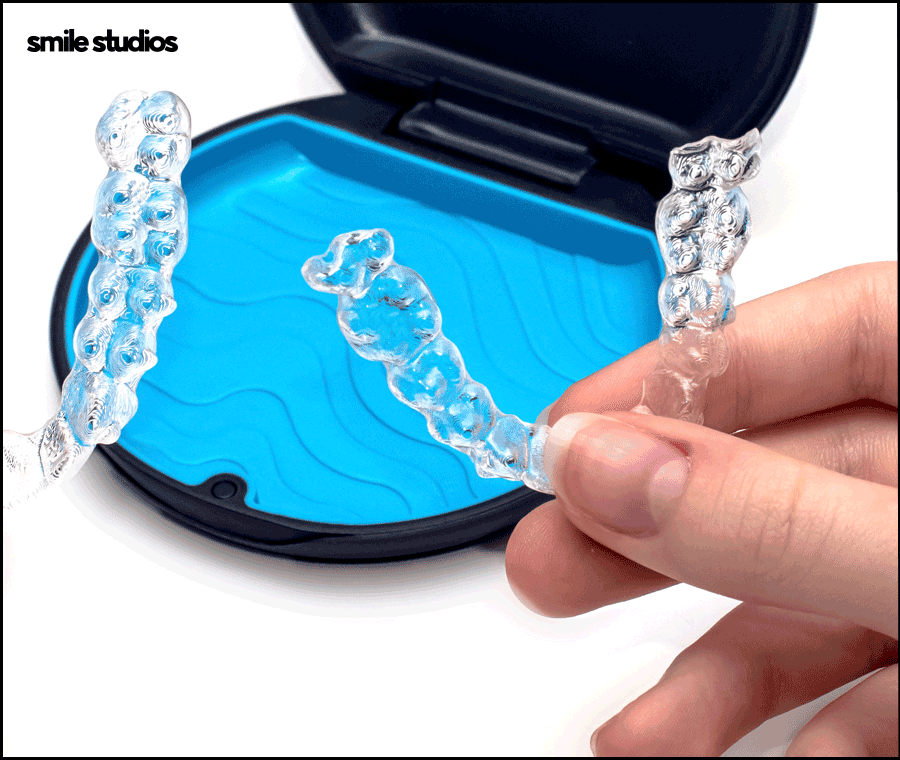 인비절라인 유지장치 착용 기간, 주의사항 알아보기 관련 이미지 3