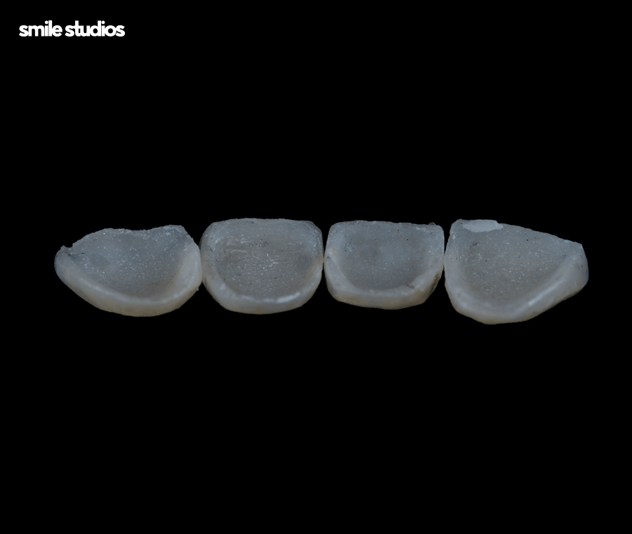 강남라미네이트 기대 효과, 원리, 유지기간 관련 이미지 7