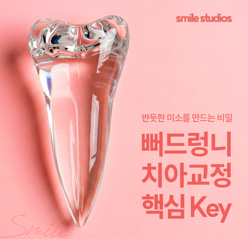 뻐드렁니 교정 성공적인 결과를 위한 key 확인 관련 이미지 1