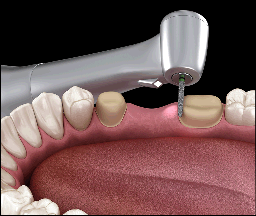 언주역치과 선택 시 꼭 확인해야 할 포인트는? 관련 이미지 4