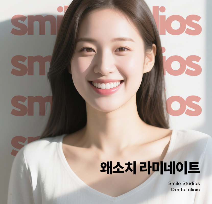 왜소치라미네이트 심미성 개선 효과, 필요성 관련 이미지 1