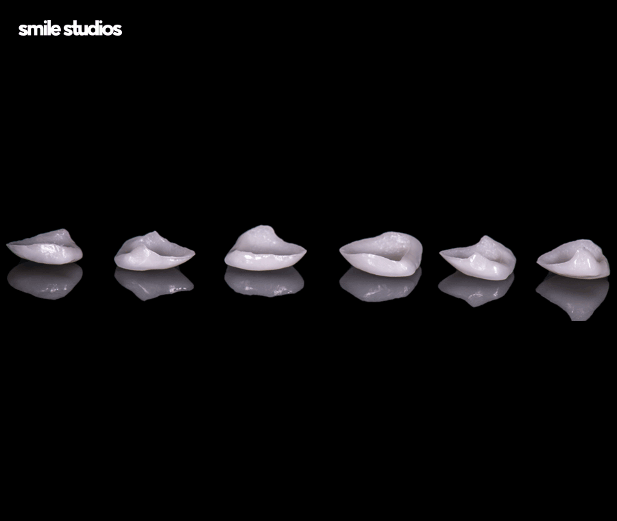 라미네이트제거 시기 및 유지력, 알아둘 사항 관련 이미지 8