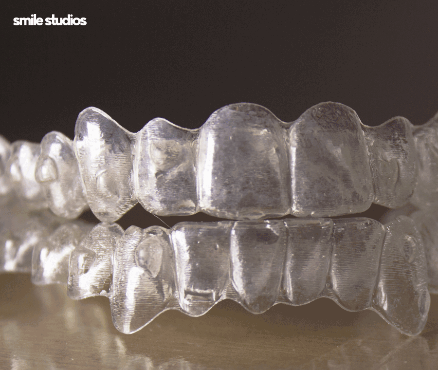 인비절라인 세척 올바른 관리 방법 확인하세요! 관련 이미지 2